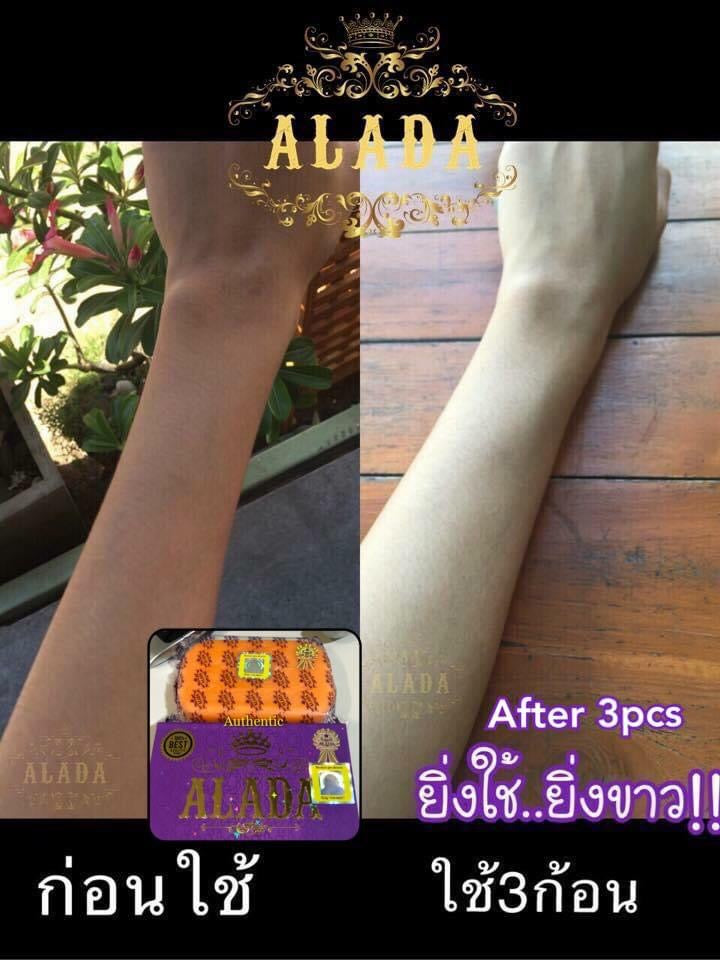 Alada Whitening Soap 160g